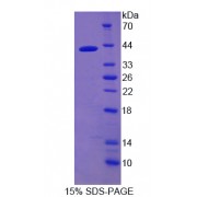 SDS-PAGE analysis of Nuclear Factor kappa B Protein.