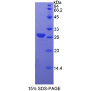 SDS-PAGE analysis of recombinant Actin Alpha 2, Smooth Muscle (ACTA2) Protein.