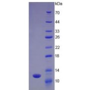 SDS-PAGE analysis of Polyubiquitin-B Protein.