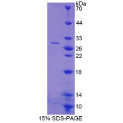 SDS-PAGE analysis of Polyubiquitin-B Protein.
