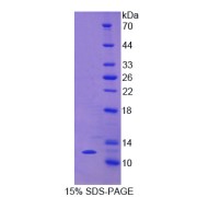 SDS-PAGE analysis of CCL5 Protein.