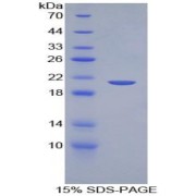 abx166395