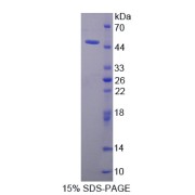 SDS-PAGE analysis of TIMP1 Protein.