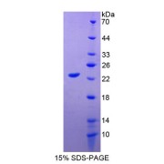 SDS-PAGE analysis of Apolipoprotein M Protein.