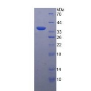 SDS-PAGE analysis of Beta-Defensin 2 Protein.