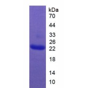 SDS-PAGE analysis of Somatotropin Protein.