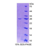 SDS-PAGE analysis of Insulin Like Growth Factor 1 Receptor (IGF1R) Protein.