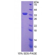 SDS-PAGE analysis of Sirtuin 5 Protein.