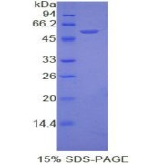 SDS-PAGE analysis of Moesin Protein.