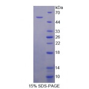 SDS-PAGE analysis of recombinant Human COL5A2 Protein.