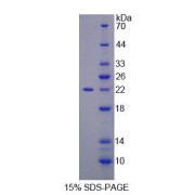 SDS-PAGE analysis of recombinant Human Spermine Oxidase Protein.