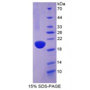 SDS-PAGE analysis of recombinant Human ACE Protein.