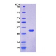 SDS-PAGE analysis of Suppressor Of Ty 6 Homolog Protein.