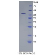 SDS-PAGE analysis of Calsyntenin 2 Protein.