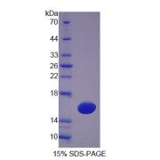 SDS-PAGE analysis of Tetraspanin 1 Protein.