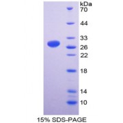 SDS-PAGE analysis of recombinant Interferon gamma Receptor 1 Protein.