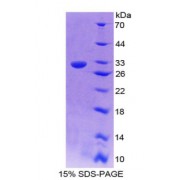 SDS-PAGE analysis of Complement Component 9 Protein.