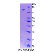 SDS-PAGE analysis of Envoplakin Protein.