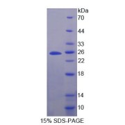 SDS-PAGE analysis of Secretogranin V Protein.