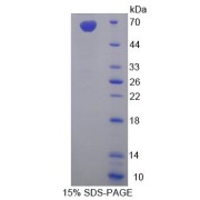 SDS-PAGE analysis of Syncoilin Protein.