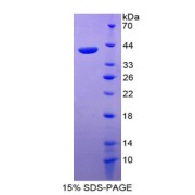 SDS-PAGE analysis of recombinant Human Reelin Protein.