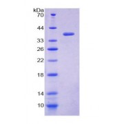 SDS-PAGE analysis of Human Loricrin Protein.