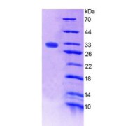 SDS-PAGE analysis of Coagulation Factor XIII A1 Polypeptide Protein.
