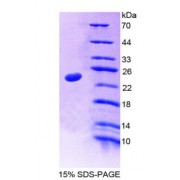 SDS-PAGE analysis of Nucleoporin 35 kDa Protein.