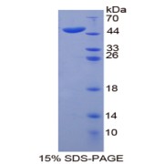 SDS-PAGE analysis of Keratin 20 Protein.