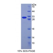 SDS-PAGE analysis of recombinant Human Granzyme B Protein.