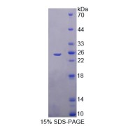 SDS-PAGE analysis of Trehalase Protein.