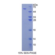 SDS-PAGE analysis of Thrombospondin 3 Protein.