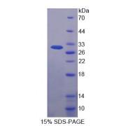 SDS-PAGE analysis of recombinant Human Lysyl tRNA synthetase Protein.
