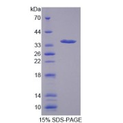 SDS-PAGE analysis of Mitoferrin Protein.
