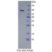 SDS-PAGE analysis of Oxoglutarate Dehydrogenase Protein.
