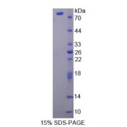 SDS-PAGE analysis of Carnitine Palmitoyltransferase 2, Mitochondrial Protein.