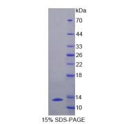 SDS-PAGE analysis of Anoctamin 6 Protein.