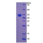 SDS-PAGE analysis of Dipeptidyl Peptidase 8 Protein.