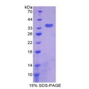 SDS-PAGE analysis of Citrate Synthase Protein.
