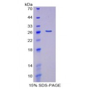 SDS-PAGE analysis of Coilin Protein.