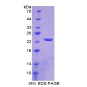 abx166654