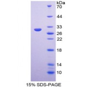 SDS-PAGE analysis of recombinant Human Arginyl Aminopeptidase Protein.