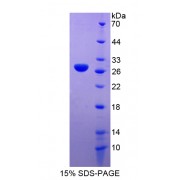 SDS-PAGE analysis of recombinant Human Gastric Intrinsic Factor Protein.