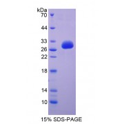 SDS-PAGE analysis of Immunoglobulin Superfamily, Member 2 Protein.
