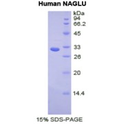 SDS-PAGE analysis of N-Acetyl alpha D-Glucosaminidase Protein.