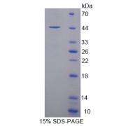 SDS-PAGE analysis of Synuclein gamma Protein.