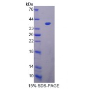 SDS-PAGE analysis of Peptidyl Arginine Deimina Type III Protein.