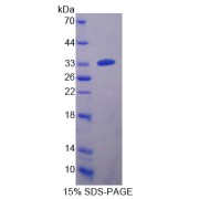 SDS-PAGE analysis of CRAT Protein.