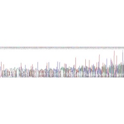 Human Kallikrein 2 (KLK2) Protein