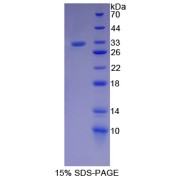 SDS-PAGE analysis of recombinant Human Protein SCAF11 Protein.